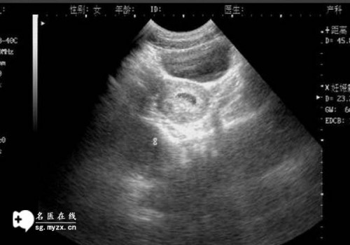 宝宝耳朵流出黄液体什么原因,婴儿耳朵流出黄液体怎么处理